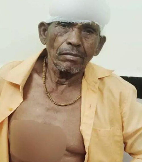 तेंदुए ने युवक पर किया हमला, गंभीर रूप से घायल